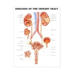 Chart, Urinary Tract Disorders